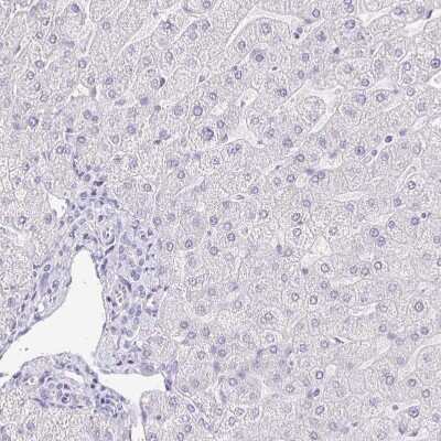 Immunohistochemistry-Paraffin: KRTDAP Antibody [NBP2-38029]