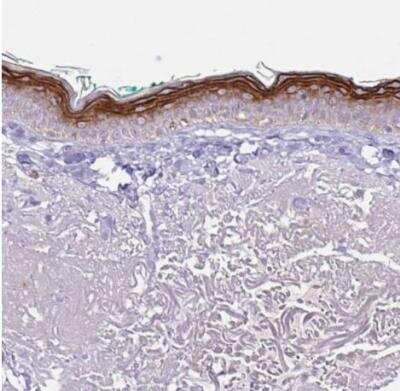 Immunohistochemistry-Paraffin: KRTDAP Antibody [NBP2-38029]