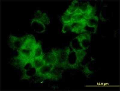 Immunocytochemistry/ Immunofluorescence: KRTHA3B Antibody (4A6-A7) [H00003884-M01]