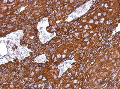 Immunohistochemistry-Paraffin: KRTHA3B Antibody [NBP2-19310]