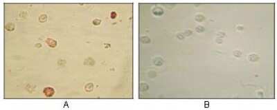 Immunohistochemistry: KSHV ORF45 Antibody (2D4A5) - BSA Free [NBP2-37685]