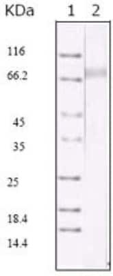 Western Blot: KSHV ORF45 Antibody (2D4A5)BSA Free [NBP2-37685]