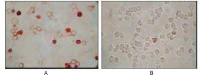 Immunohistochemistry: KSHV ORF62 Antibody (5B7B6) - BSA Free [NBP2-37684]