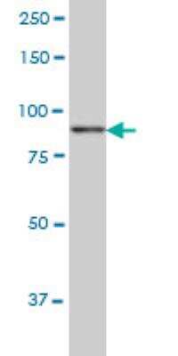 Western Blot: KSR2 Antibody (1G4) [H00283455-M08]