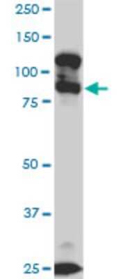 Western Blot: KSR2 Antibody (5C4) [H00283455-M05]