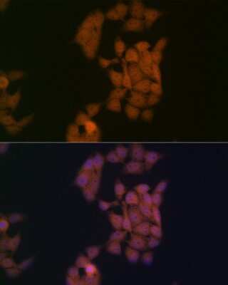 Immunocytochemistry/ Immunofluorescence: Kaiso Antibody (10O4V2) [NBP3-16272]