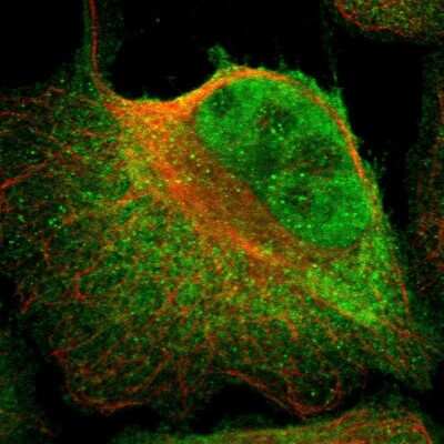 Immunocytochemistry/ Immunofluorescence: Kaiso Antibody [NBP1-87866]