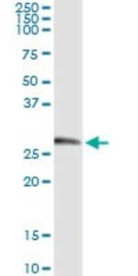 Immunoprecipitation: Kallikrein 2 Antibody (3C5) [H00003817-M03]