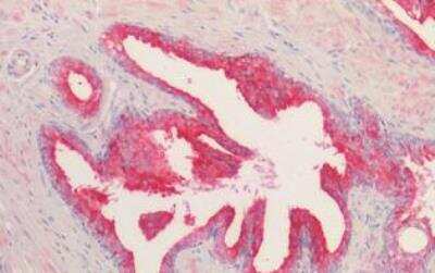 Immunohistochemistry-Paraffin: Kallikrein 2 Antibody [NBP1-06046]