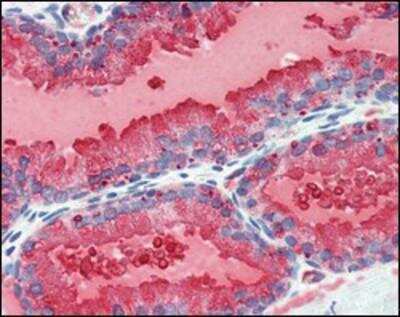 Immunohistochemistry-Paraffin: Kallikrein 3/PSA Antibody (5A11E9) - BSA Free [NBP1-51541]
