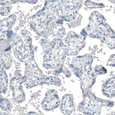Immunohistochemistry-Paraffin: Kallikrein 3/PSA Antibody (CL9414) [NBP3-05505]