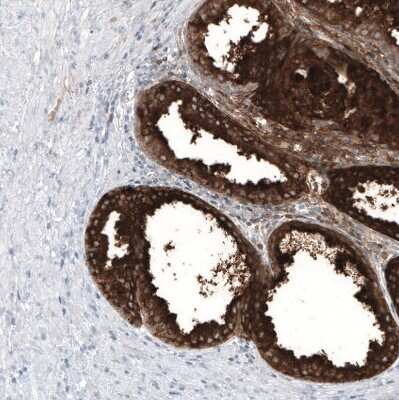 Immunohistochemistry-Paraffin: Kallikrein 3/PSA Antibody (CL9414) [NBP3-05505]