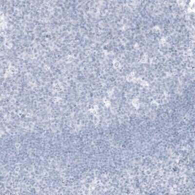 Immunohistochemistry-Paraffin: Kallikrein 3/PSA Antibody (CL9414) [NBP3-05505]
