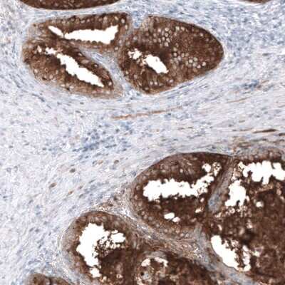 Immunohistochemistry-Paraffin: Kallikrein 3/PSA Antibody (CL9422) [NBP3-05506]