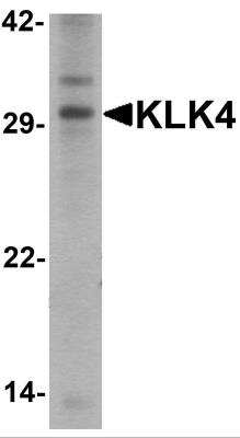 Western Blot: Kallikrein 4/Prostase/EMSP1 AntibodyBSA Free [NBP2-81838]