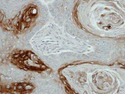 Immunohistochemistry-Paraffin: Kallikrein 7 Antibody [NBP1-31428]
