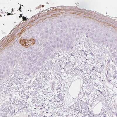 Immunohistochemistry-Paraffin: Kallikrein 7 Antibody [NBP2-38950]