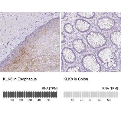 Immunohistochemistry-Paraffin: Kallikrein 8/Neuropsin Antibody [NBP3-05517]