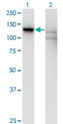 Western Blot: Kanadaptin Antibody (2G10) [H00022950-M01]