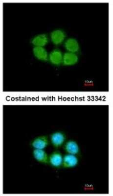 Immunocytochemistry/ Immunofluorescence: Kanadaptin Antibody [NBP2-17014]