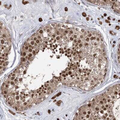 Immunohistochemistry: Kanadaptin Antibody [NBP2-38315]