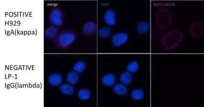 Immunocytochemistry/ Immunofluorescence: Kappa Light Chain Antibody (HP6053 + L1C1) - Azide and BSA Free [NBP2-34640]