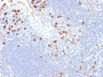 Immunohistochemistry-Paraffin: Kappa Light Chain Antibody (HP6053) - IHC-Prediluted [NBP2-45084]