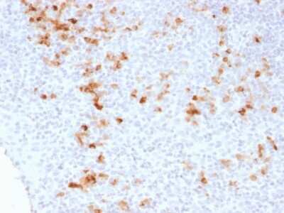 Immunohistochemistry-Paraffin: Kappa Light Chain Antibody (KLC1278) - Azide and BSA Free [NBP2-54512]