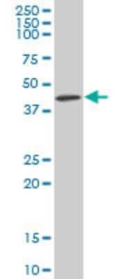 Western Blot: Kaptin Antibody (1C7) [H00011133-M01]