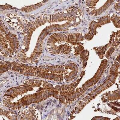Immunohistochemistry-Paraffin: Kaptin Antibody [NBP1-92034]