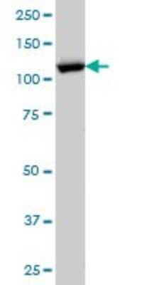 Western Blot: Karyopherin (importin) beta 3 Antibody (1C4) [H00003843-M01]