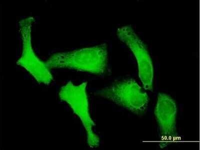 Immunocytochemistry/ Immunofluorescence: Karyopherin (importin) beta 3 Antibody [H00003843-B01P]