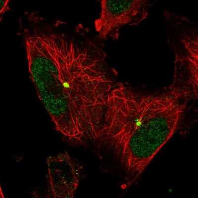 Immunocytochemistry/ Immunofluorescence: Katanin p60 Antibody [NBP1-89491]
