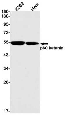 Western Blot: Katanin p60 Antibody (S05-3B9) [NBP3-15050]