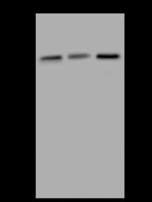 Western Blot: Katanin p60 Antibody [NBP2-97830]