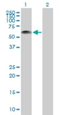 Western Blot: Kazrin Antibody [H00023254-B01P]