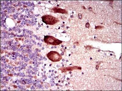Immunohistochemistry-Paraffin: Keap1 Antibody (7G4B10) - BSA Free [NBP2-37431]