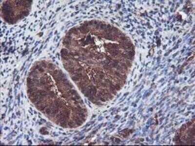 Immunohistochemistry: Keap1 Antibody (OTI1B4) - Azide and BSA Free [NBP2-71496]