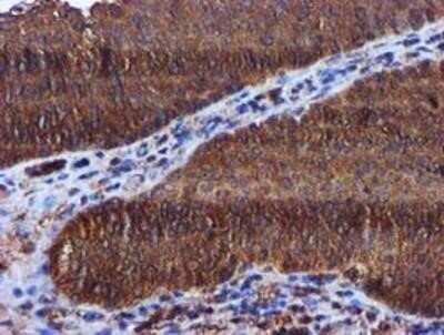 Immunohistochemistry: Keap1 Antibody (OTI1B4) - Azide and BSA Free [NBP2-71496]