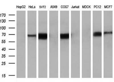 Western Blot: Keap1 Antibody (OTI1B4) [NBP2-03319]