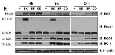 Western Blot: Keap1 Antibody (OTI1B4) [NBP2-03319]
