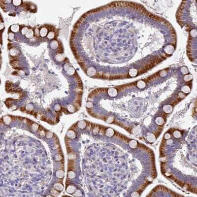 Immunohistochemistry-Paraffin: Kelch-Like 3 Antibody [NBP2-14168]