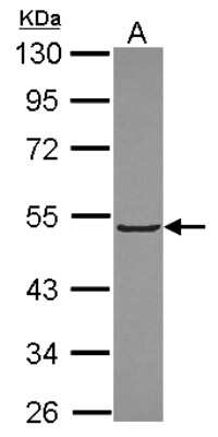 Western Blot: Kelch-Like 3 Antibody [NBP2-17037]