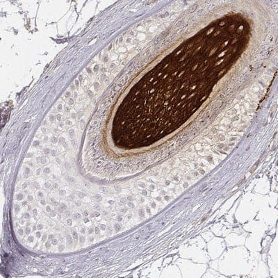 Immunohistochemistry-Paraffin: Keratin 31 Antibody [NBP2-33572]