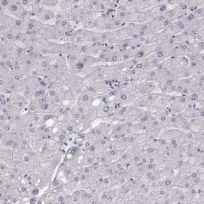 Immunohistochemistry-Paraffin: Keratin 31 Antibody [NBP2-46823]