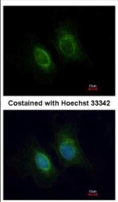 Immunocytochemistry/ Immunofluorescence: Keratin 36 Antibody [NBP2-17038]