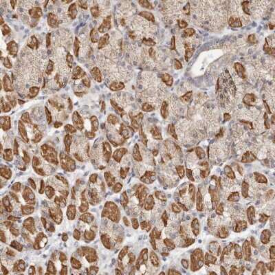Immunohistochemistry-Paraffin: Keratinocyte Differentiation Factor 1 Antibody [NBP1-93838]
