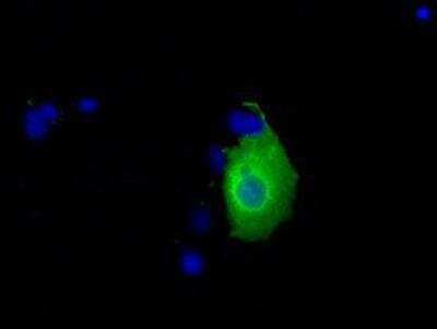 Immunocytochemistry/ Immunofluorescence: Ketohexokinase Antibody (OTI1D8) [NBP2-02639]