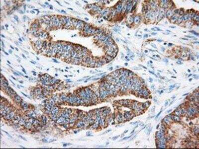 Immunohistochemistry-Paraffin: Ketohexokinase Antibody (OTI1D8) [NBP2-02639]