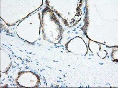Immunohistochemistry-Paraffin: Ketohexokinase Antibody (OTI1D8) [NBP2-02639]